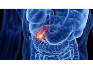 Dr. Nitin Bhel for Gallbladder Cancer Treatment in Ludhiana