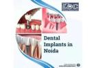 Teeth Cleaning and Whitening in Noida | Ethical Dental Care