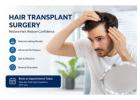 Best Hair Transplant Surgery Doctors in Delhi | DocIndia