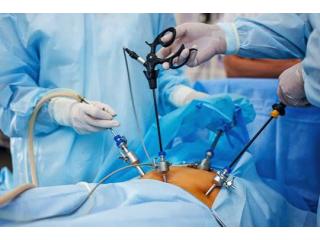 Expert Care by the Best Laparoscopic Surgeon in Kolkata