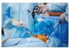 Expert Care by the Best Laparoscopic Surgeon in Kolkata