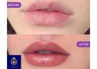 Professional Lip Blushing in Thane | DNA Royal.