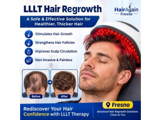 lllt hair regrowth fresno