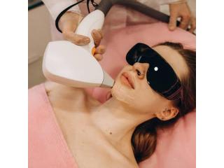 Harmony Laser Treatment Chino Hills for Smooth Skin