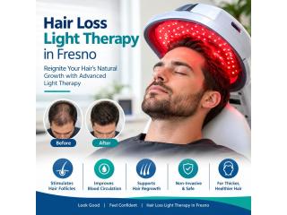 hair loss light therapy fresno