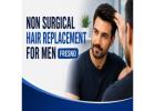 Non Surgical Hair Replacement For Men in Fresno