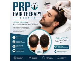 PRP Hair Therapy fresno