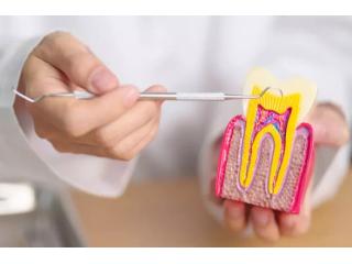 Professional Dental Implants Services in Rosedale, MD