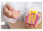 Professional Dental Implants Services in Rosedale, MD