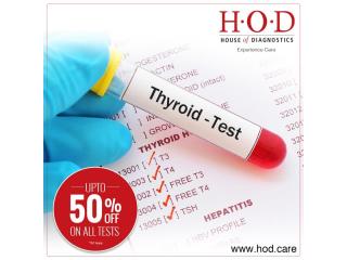 TSH Testing for Hypothyroidism and Hyperthyroidism