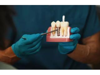 Trusted Professional Teeth Whitening at Rosedale Smiles
