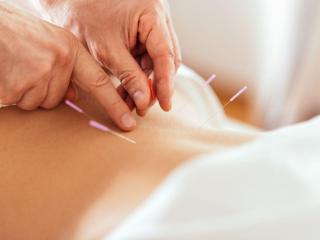 Pain Management Acupuncture in NYC | Back, Neck & Sciatica Relief