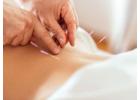 Pain Management Acupuncture in NYC | Back, Neck & Sciatica Relief