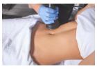 Body Contouring Tampa FL for a Sculpted, Defined Look