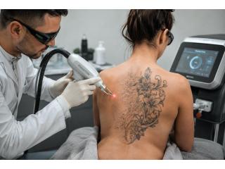 When Your Tattoo No Longer Feels Like You