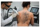 When Your Tattoo No Longer Feels Like You