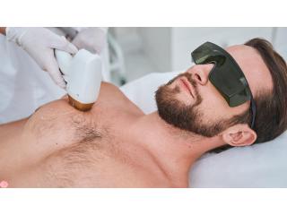 Advanced Laser Hair Removal for Men in Dubai