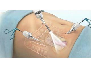 Best Hernia Surgeon in Dum Dum Park for Expert Treatment