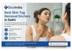 Best Skin Tag Removal Doctors in Delhi - Book Online | DocIndia