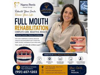 Full Mouth Rehabilitation for Complete Smile - Nuevo
