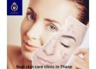 DNA Royal – Best Skin Care Clinic in Thane for Advanced Skin Treatments.