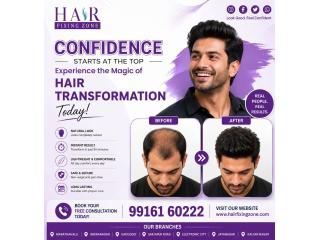 Natural Look. Instant Results