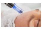 Professional Microneedling in Reading | Ankita B Dhingra