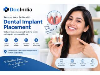 Best Dental Implant Placement Doctors in Delhi | Book Online | DocIndia