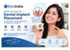 Best Dental Implant Placement Doctors in Delhi | Book Online | DocIndia
