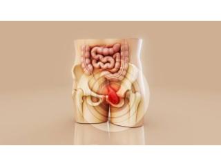Best Piles Surgeon in Kolkata for Effective and Reliable Treatment