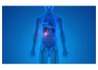 Dr. Kyriakos Neofytou: Recognizing Gallstone Symptoms and Understanding Digestive Health