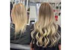 Book Online Private Hair Loss Consultation in Dallas