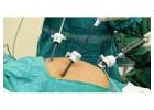 Gall Stone Surgery in Kolkata with Dr. Purnendu Roy