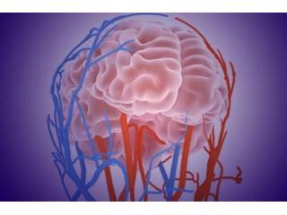 Stenting Renal Artery Treatment for Better Blood Flow