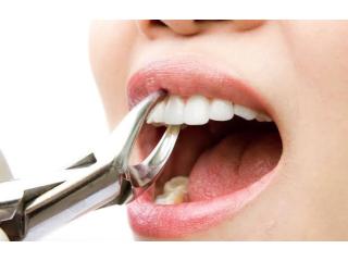 Need Beverly Hills Dental Implants You Can Rely On?