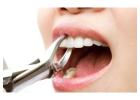 Need Beverly Hills Dental Implants You Can Rely On? 