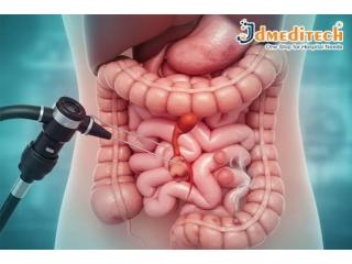 Advanced Surgical Solutions for Stomach & Colon in Kolkata