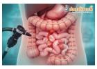 Advanced Surgical Solutions for Stomach & Colon in Kolkata