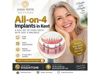 What Is the Cost of All-on-4 Implants in Kent?