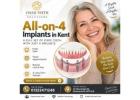 What Is the Cost of All-on-4 Implants in Kent?