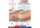 Best Laser Hair Removal in Mira Road – Sparkle Cosmetic Clinic