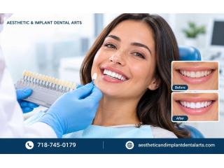 Expert Teeth Whitening from a Trusted Brooklyn Dentist