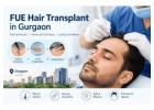 Best FUE Hair Transplant in Gurgaon with Zero Scars