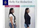 Best Slimming Treatment in Thane for a Healthier You | DNA Royal.