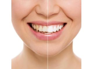 Dentist in West Midtown for Family Dental Care