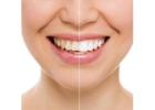 Dentist in West Midtown for Family Dental Care