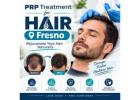 prp treatment for hair Fresno
