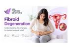 Could Your Fibroid Be Degenerating? Signs, Causes & Treatment