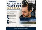 plasma rich platelet therapy for hair loss Fresno  