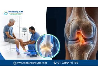 A Quick Guide OF Arthroscopic ACL Treatment in Bangalore - Dr.Nataraj H M